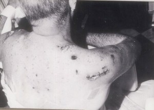 Imbert Barrera, atentado 1